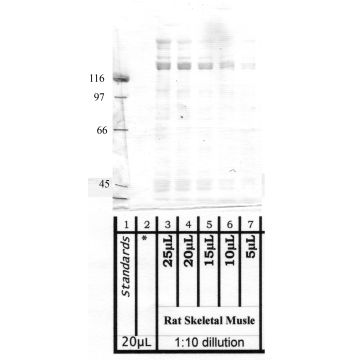 Anti-ADAMTS-6 Rabbit Polyclonal Antibody