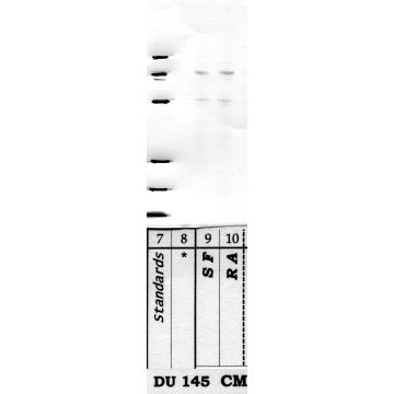 DPP-10: Stalk region — WB validation