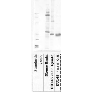 Anti-DPP-6 Rabbit Polyclonal Antibody