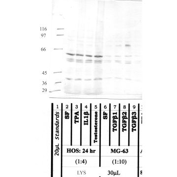 ADAM-8: Carboxy end Propeptide Domain — WB validation