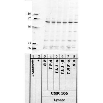 ADAMTS-5: Propeptide domain — WB validation