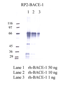 BACE-1 Stalk region antibody Western blot validation