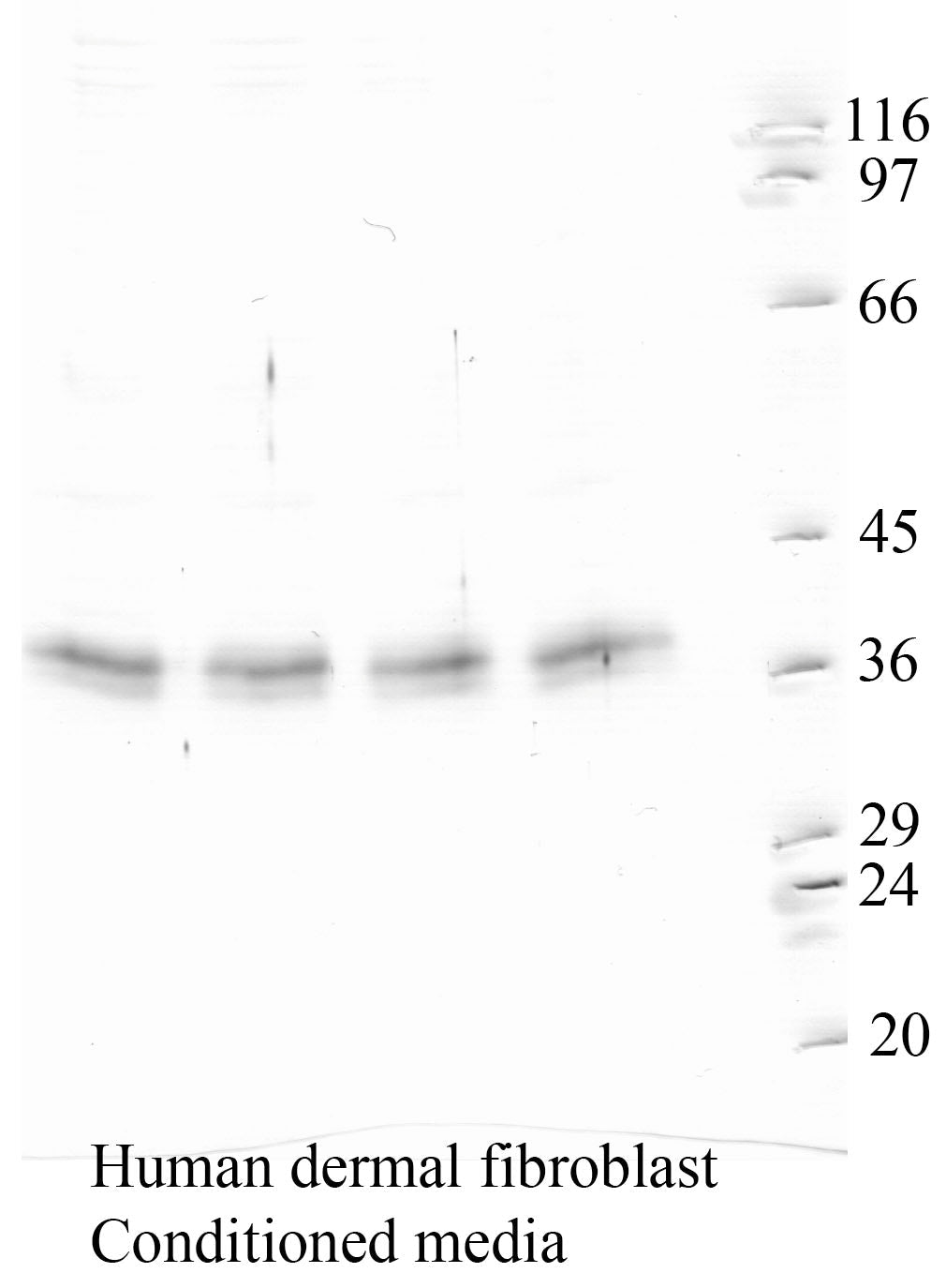 Cathepsin-K: Propeptide domain — WB validation