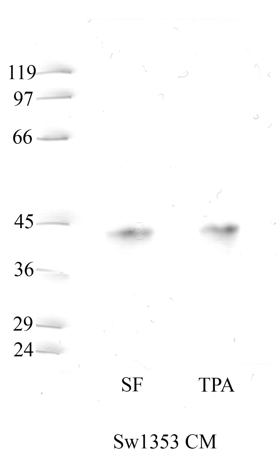 Cathepsin-L: Propeptide domain — WB validation