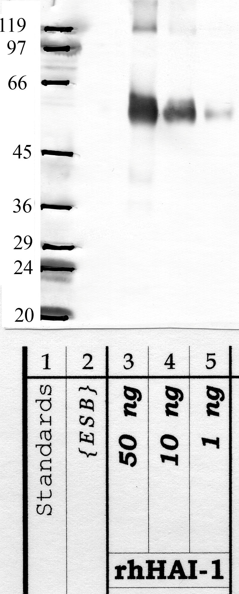 HAI-1: aminoterminal end mature HAI-1 — WB validation