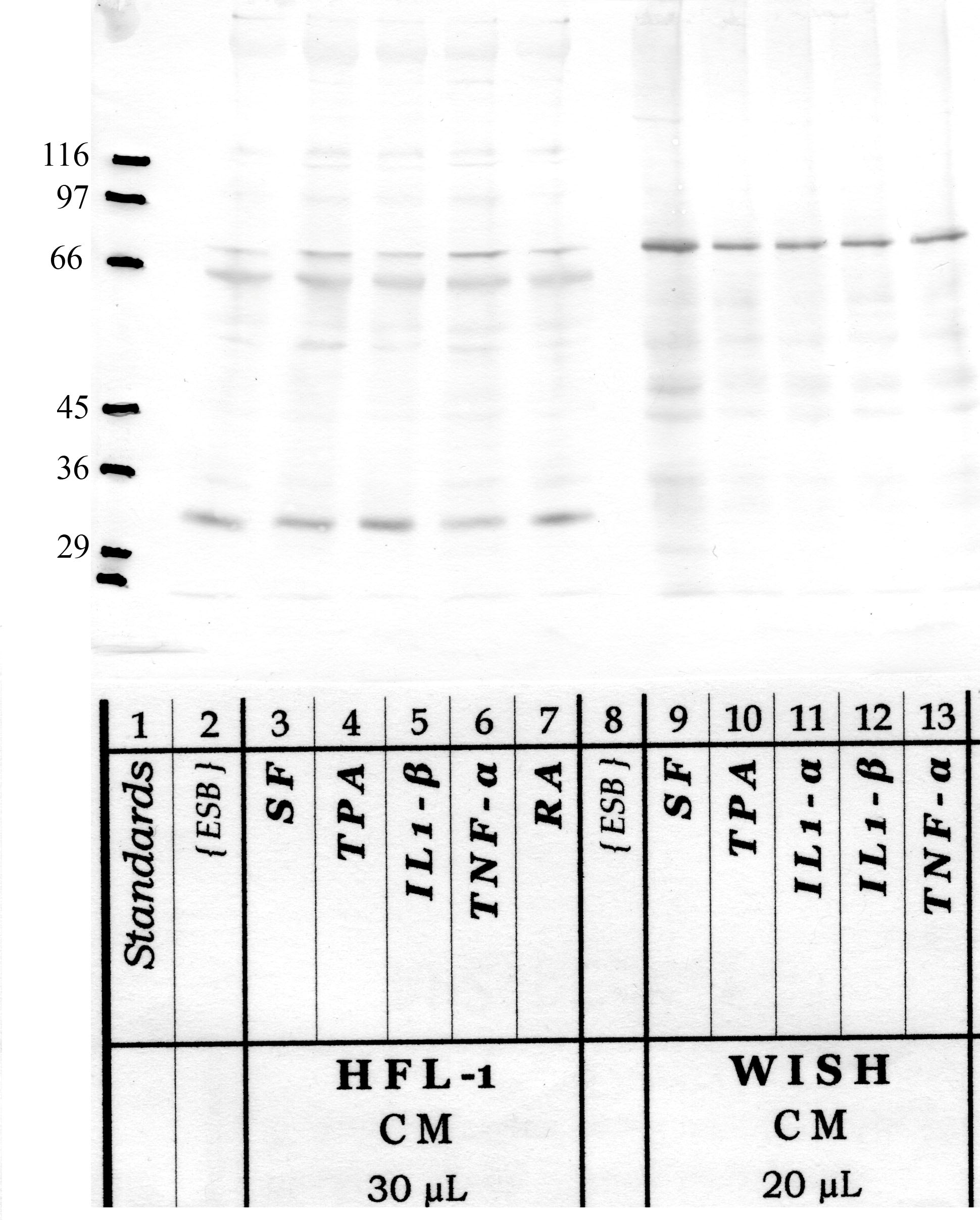 RECK: Amino end — WB validation