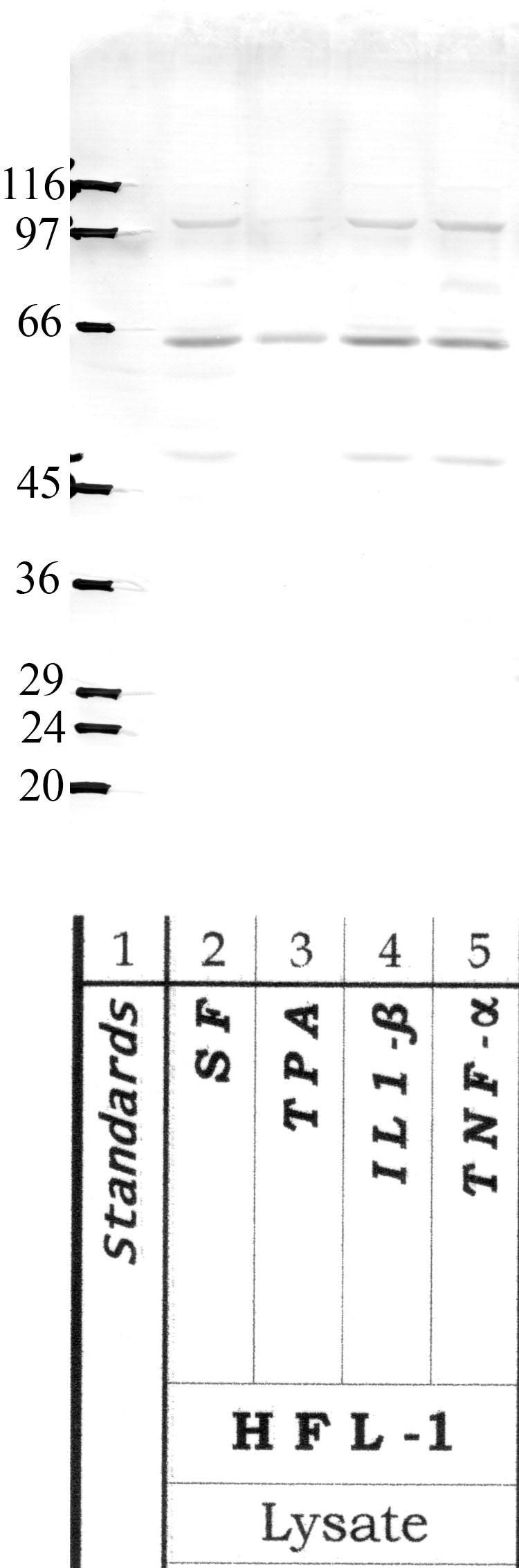 Serpin-B9: Amino end mature Serpin-B9 — WB validation