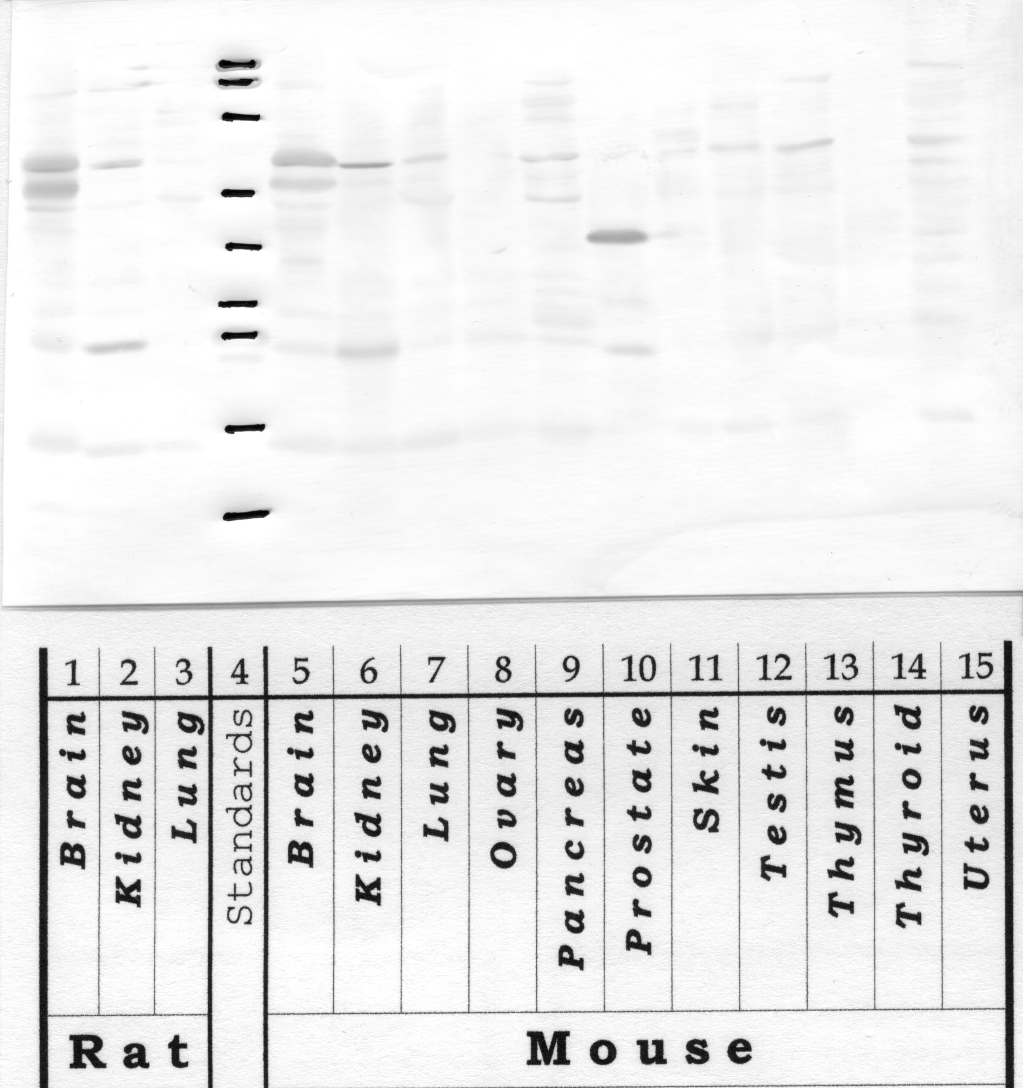 Kallikrein-12: Kallikrein loop — WB validation