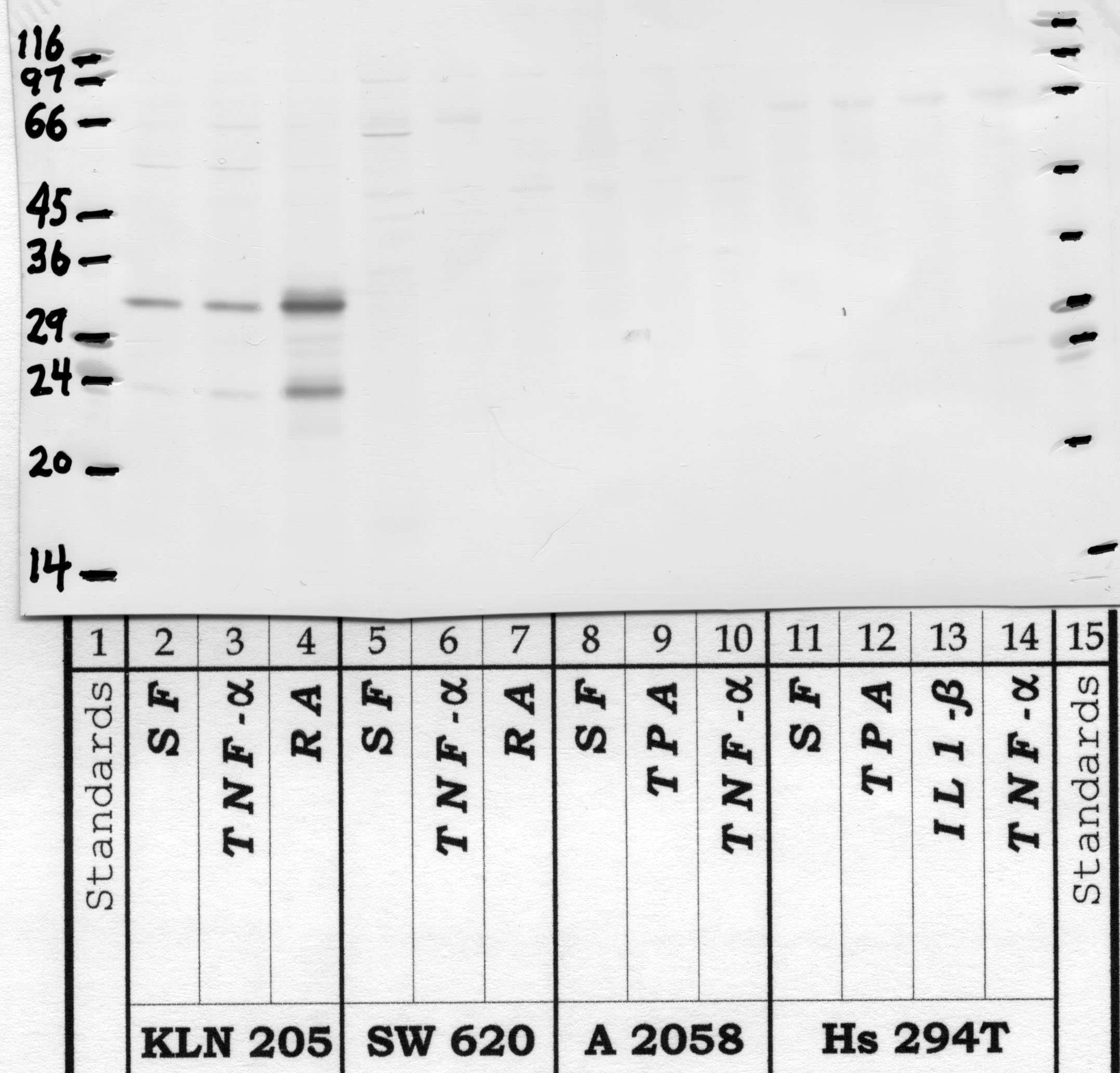 Kallikrein-15: Kallikrein loop — WB validation