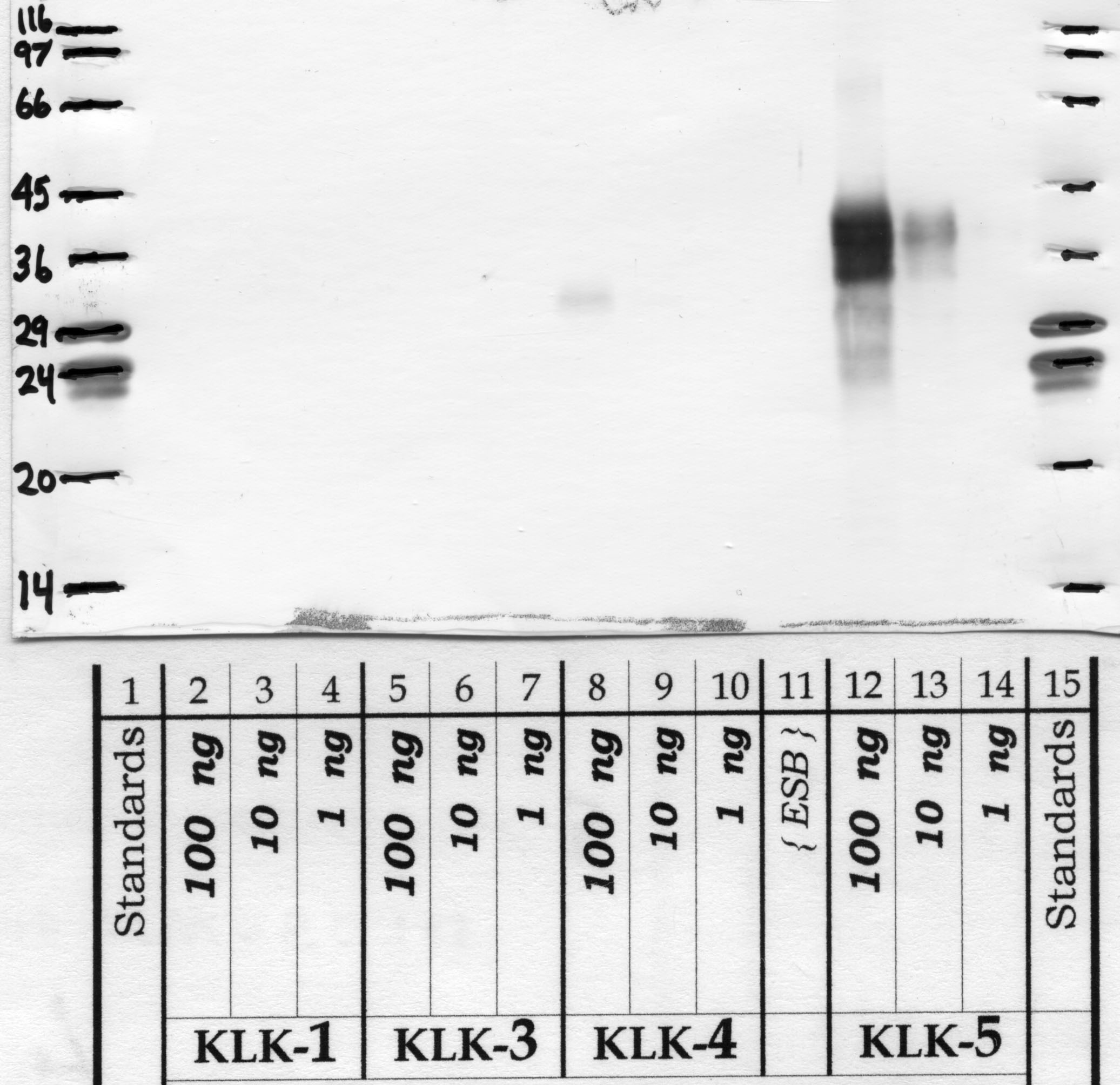 Kallikrein-5: Kallikrein loop — WB validation