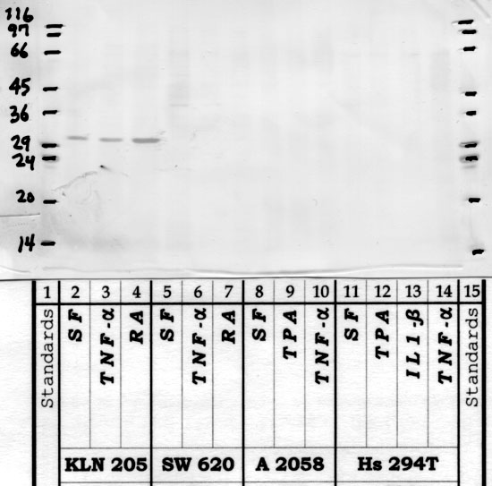Kallikrein-15: Catalytic domain — WB validation