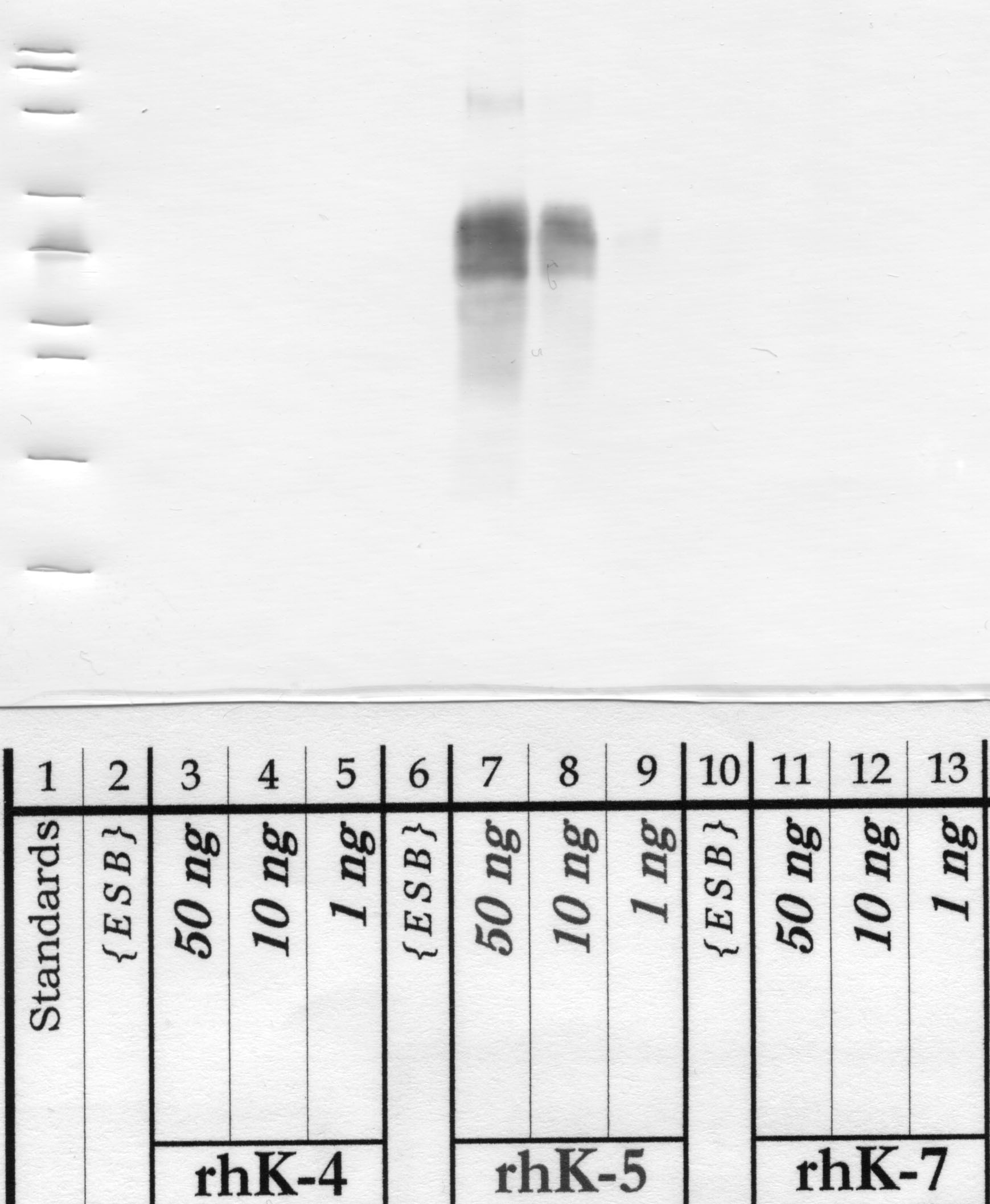 Kallikrein-5: Catalytic domain — WB validation