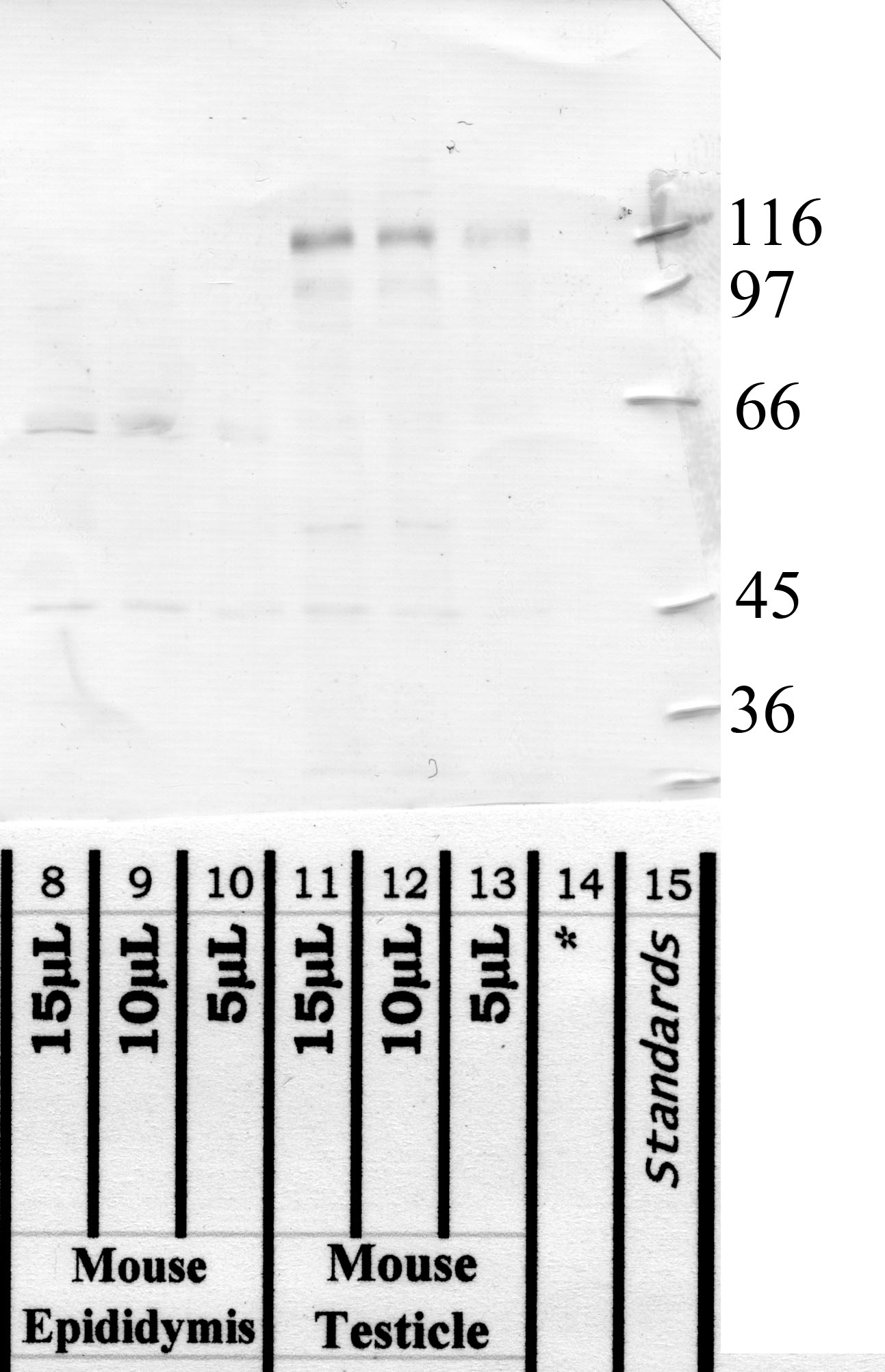 ADAM-1: Propeptide domain — WB validation