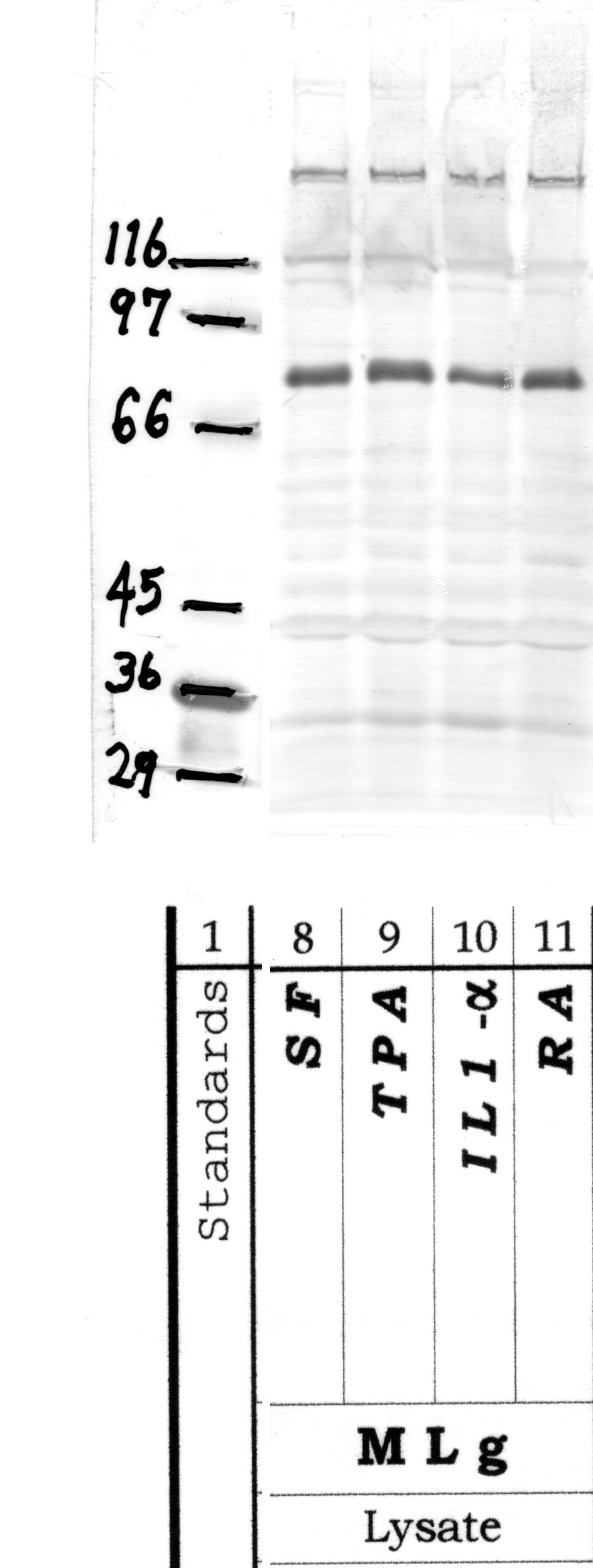 ADAMTS-16: Propeptide domain — WB validation
