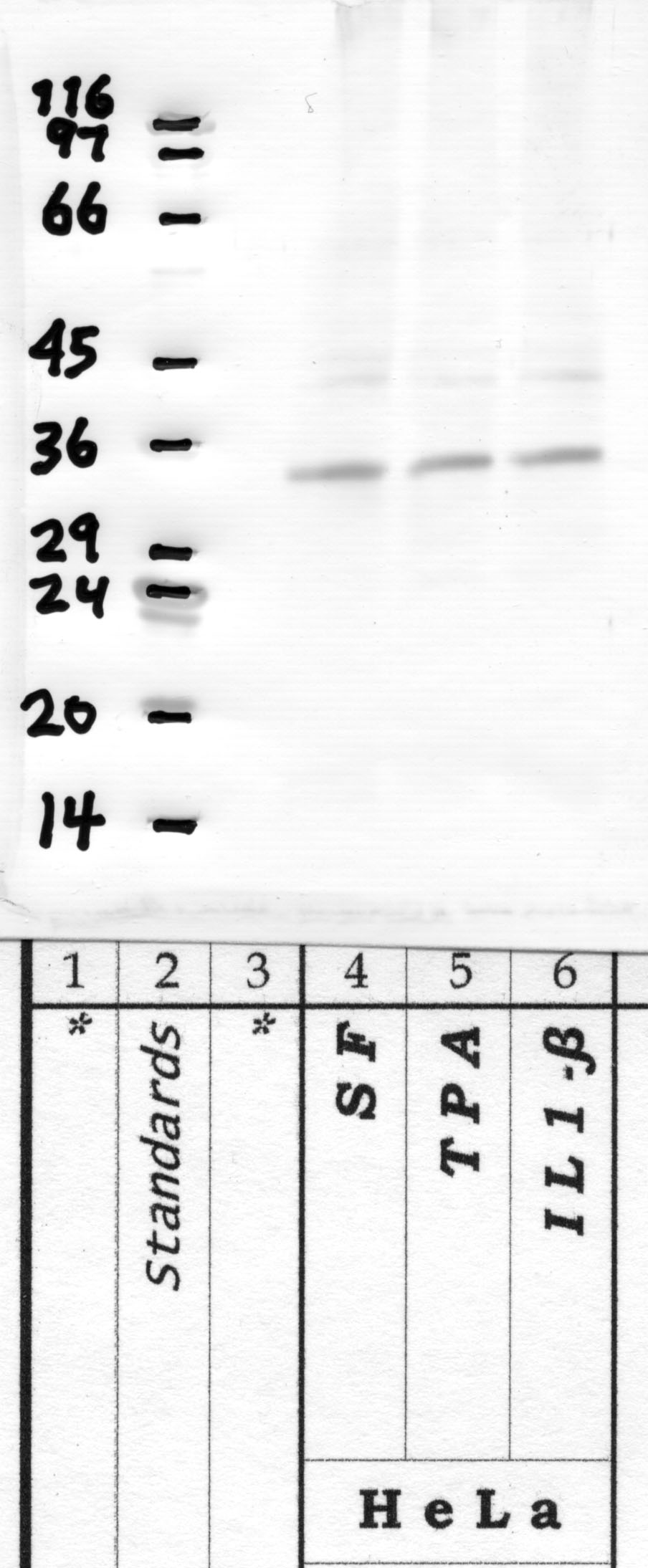 Marapsin-2: Catalytic domain — WB validation