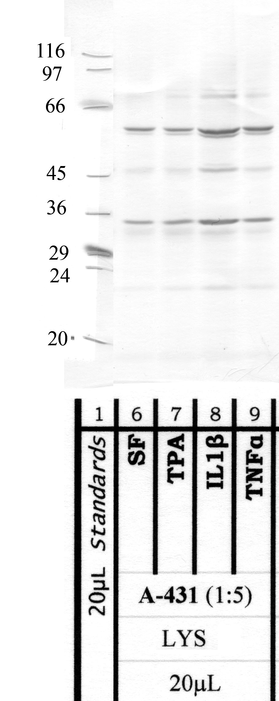 MMP-25: Hinge region — WB validation