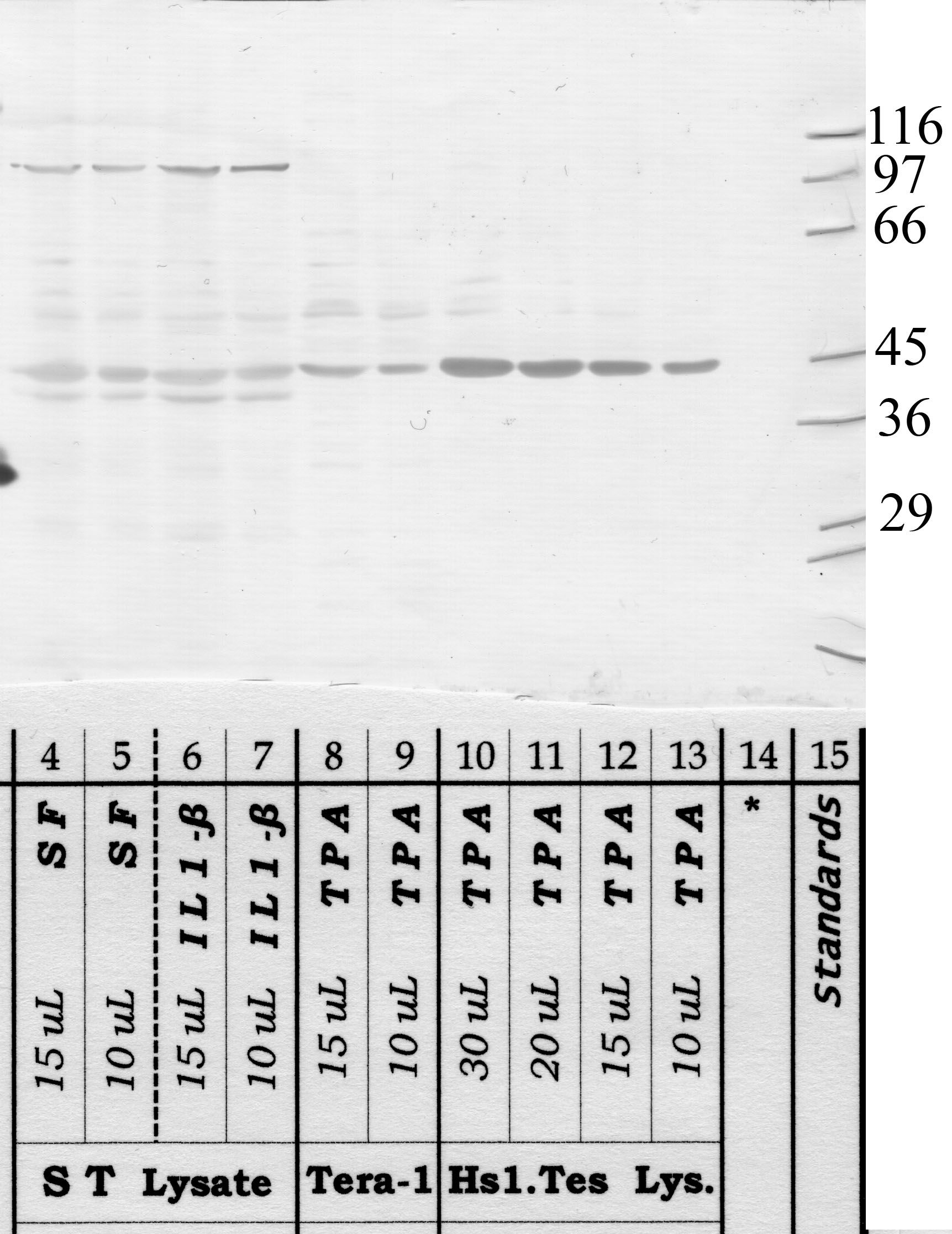 ADAM-1: Metalloproteinase domain — WB validation