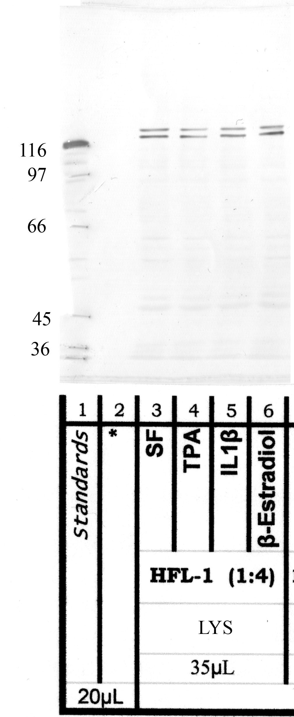 ADAMTS-7: Propeptide domain — WB validation