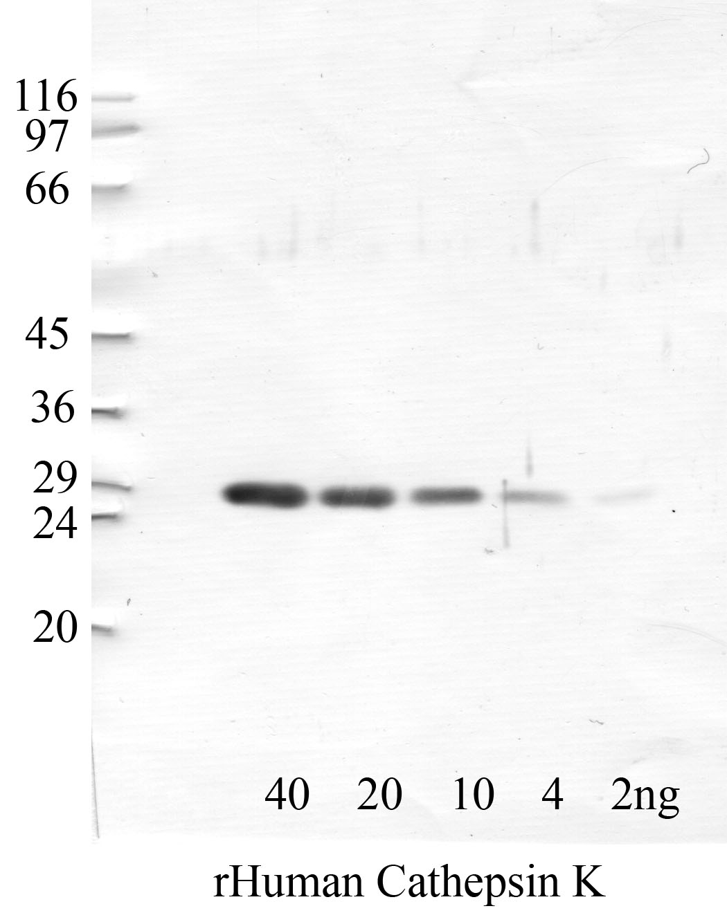 Cathepsin-K: Catalytic domain — WB validation