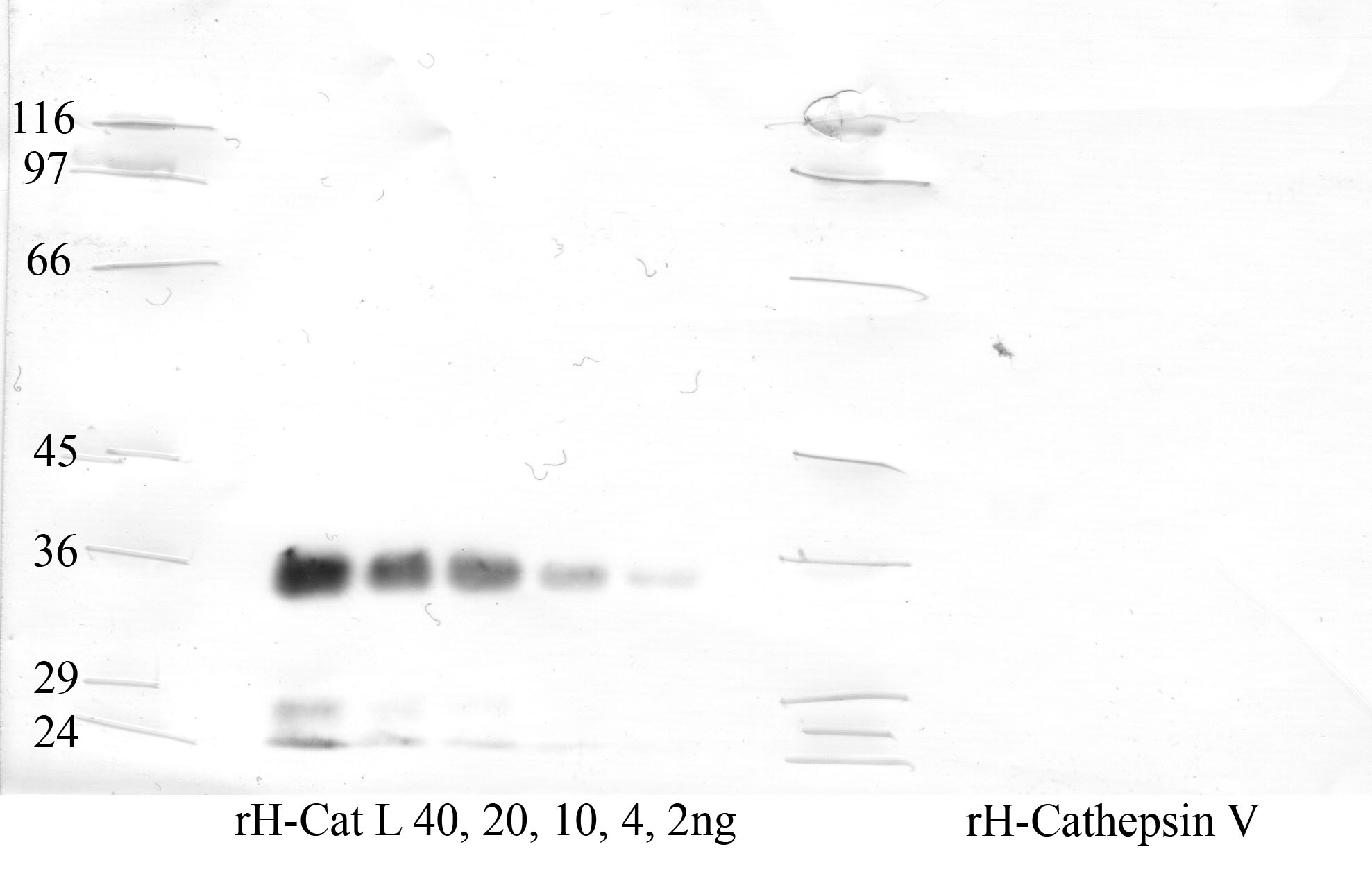 Cathepsin-L: Catalytic domain — WB validation
