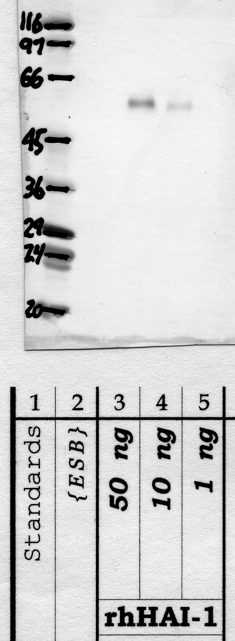 HAI-1: KD1 insert — WB validation