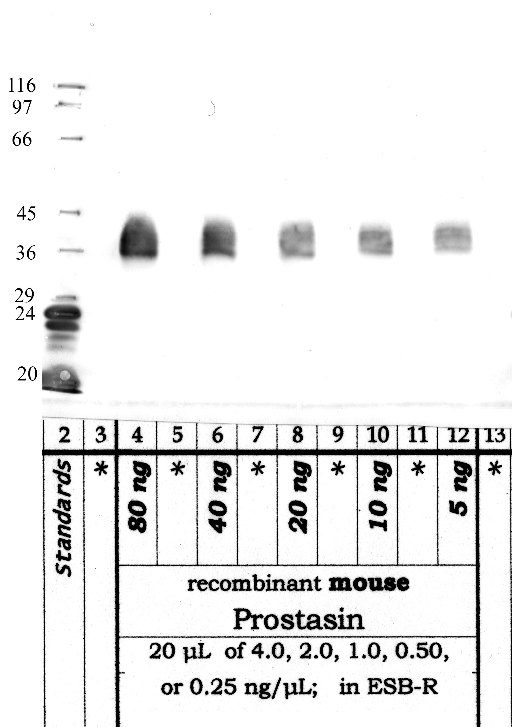 Prostasin: Catalytic domain — WB validation