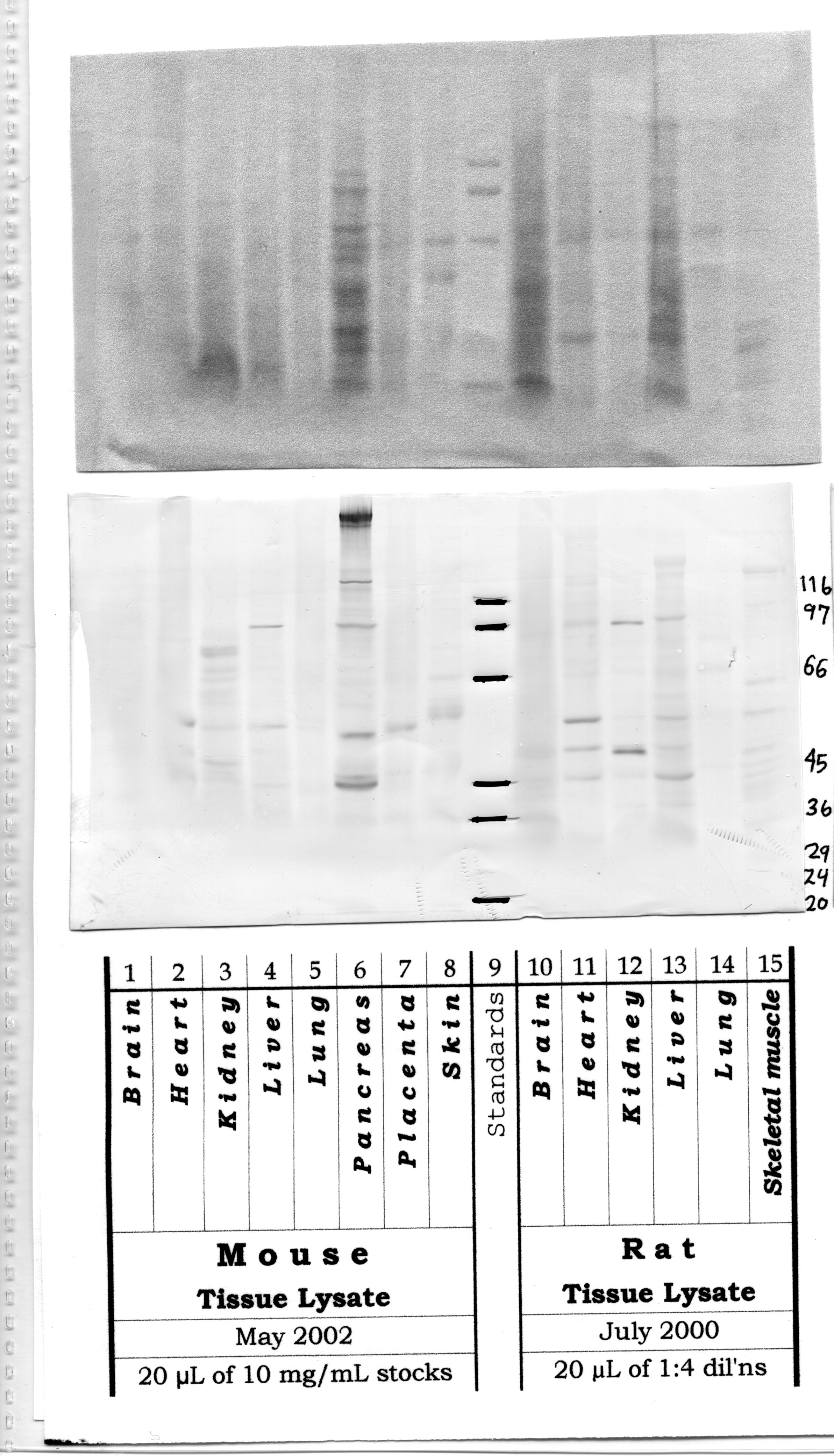 ADAMTS-7: Carboxy end Propeptide Domain — WB validation