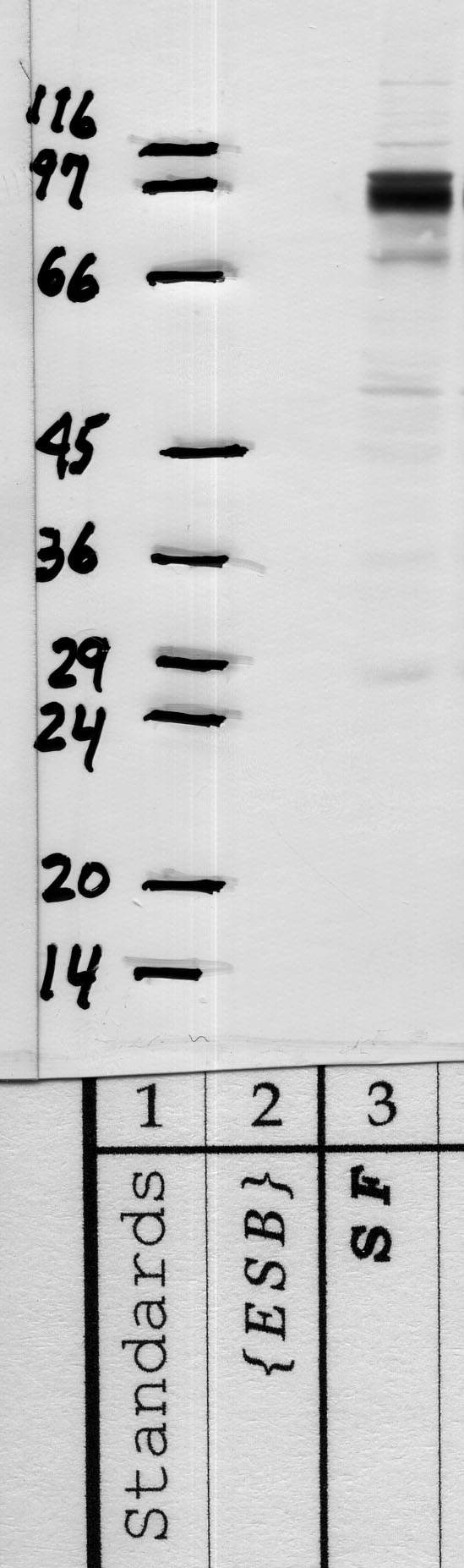 HAI-1: Cytoplasmic domain — WB validation
