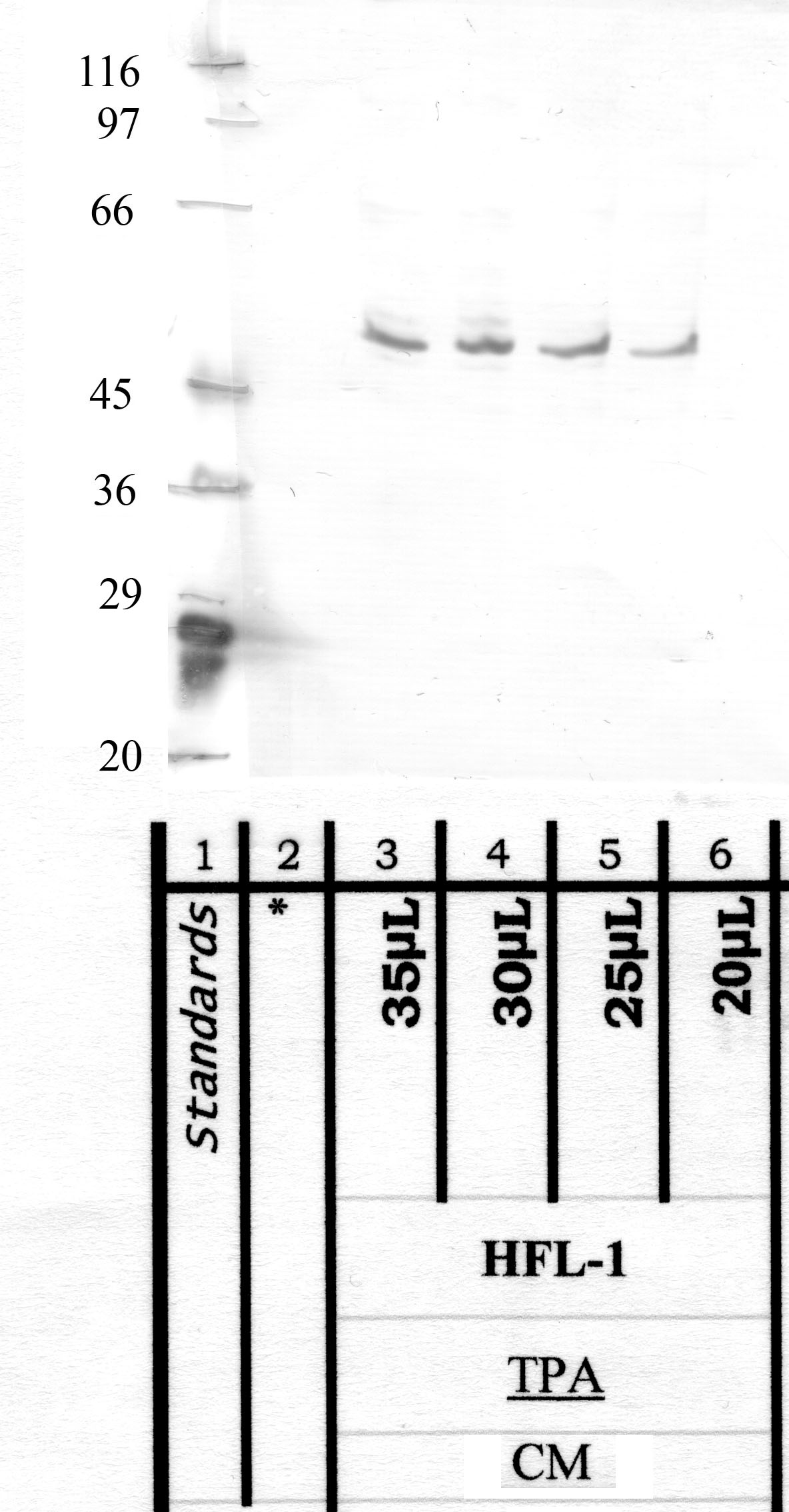 TMPRSS-11A: Catalytic domain — WB validation