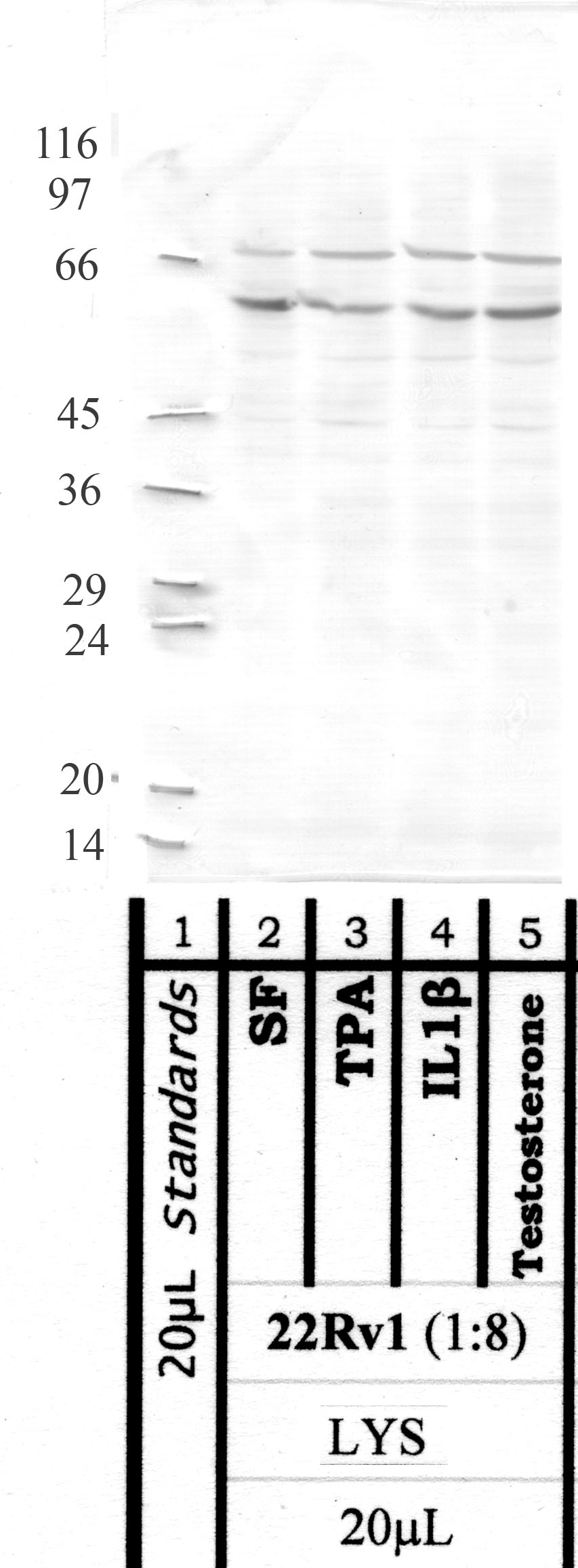 MMP-25: Propeptide domain MMP-25 — WB validation