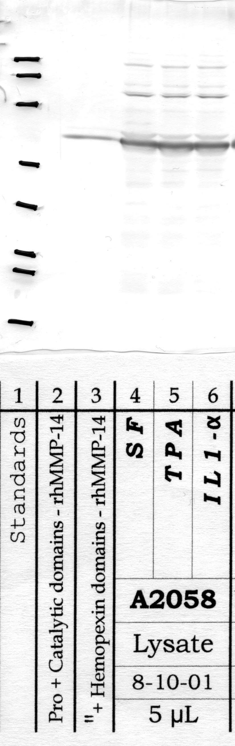 MMP-14: Â Aminoterminal end of active enzyme — WB validation